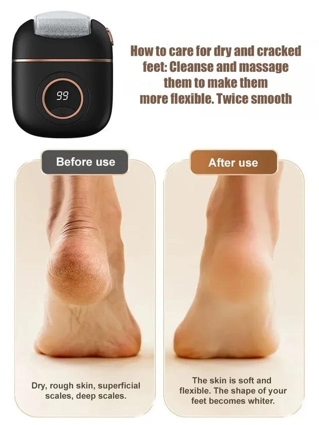 💝New Digital Electric Foot Polisher